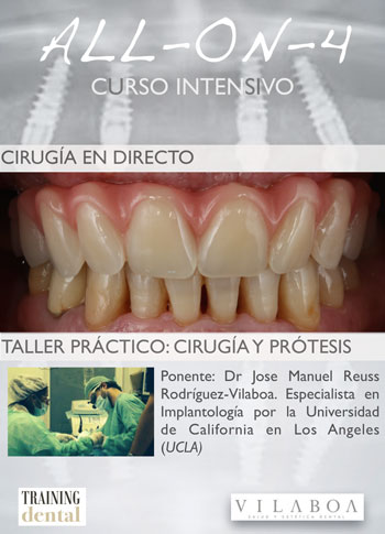 curso intensivo 2016